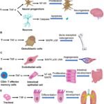 TNF: Understanding Tumor Necrosis Factor 